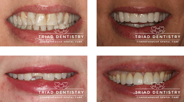 Restorative VS Cosmetic Dentistry - 123Dentist